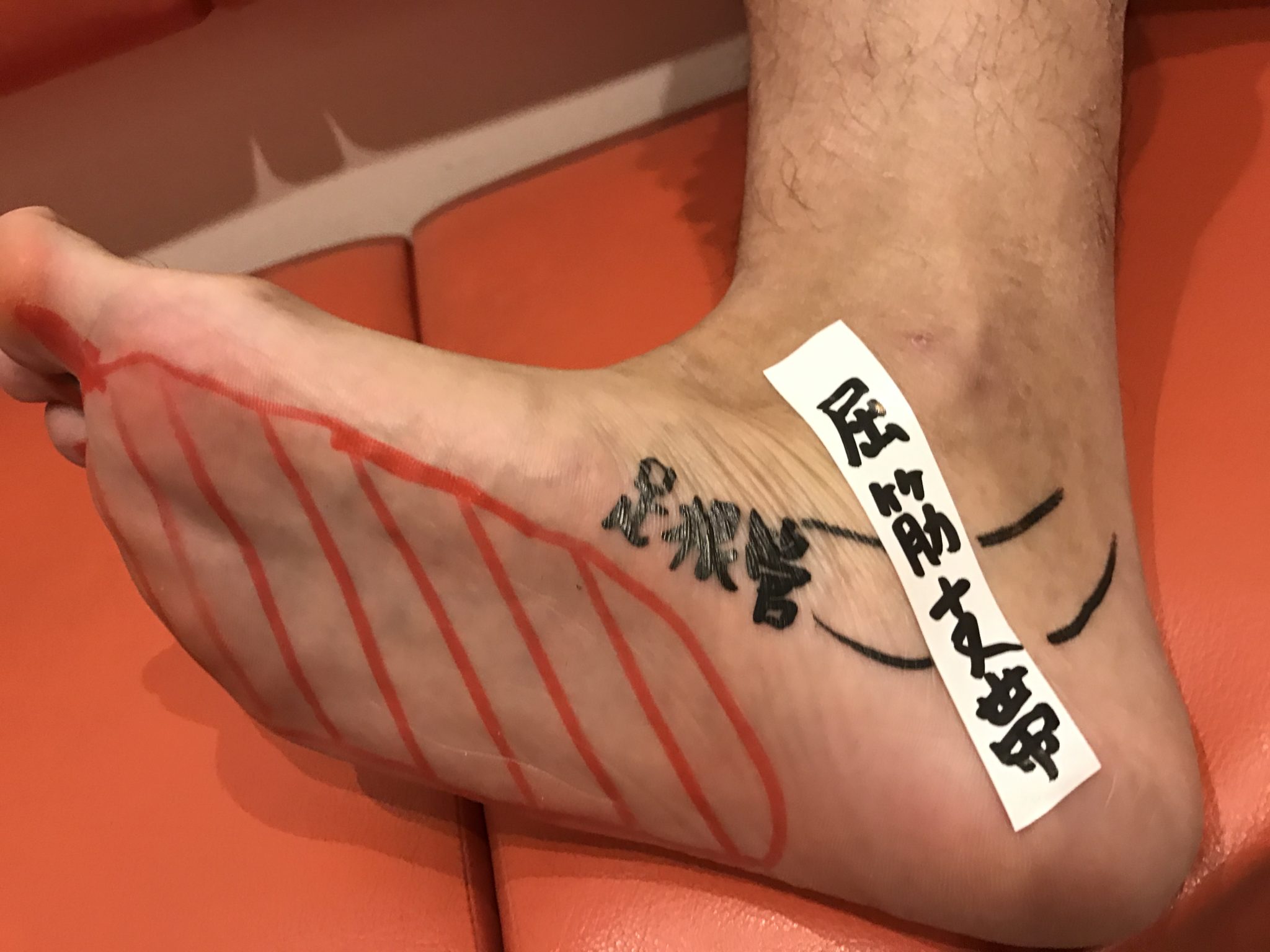 足根管,イメージ