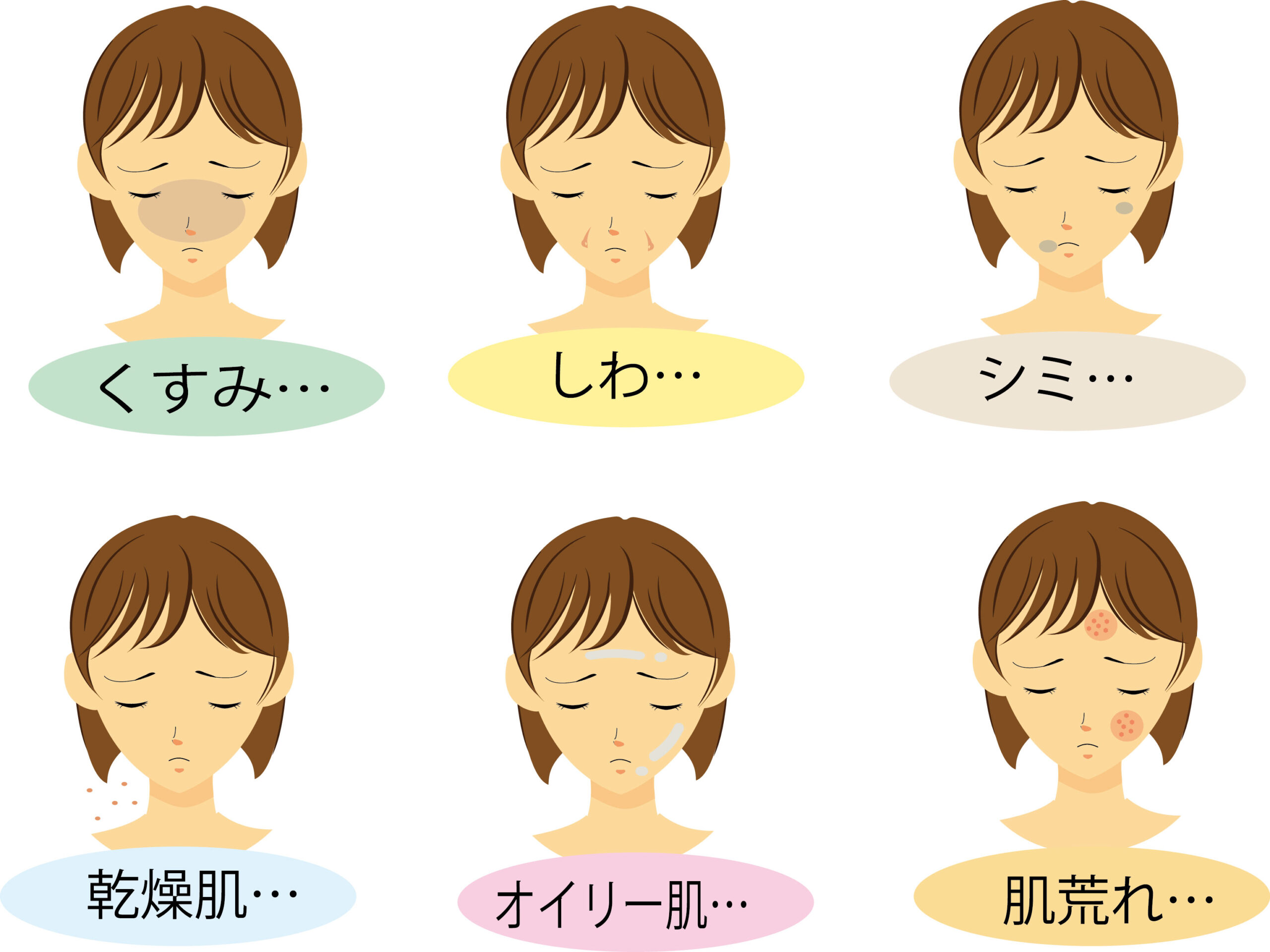 女性の肌トラブルの例,イメージ